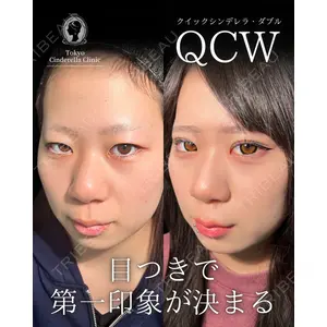 東京シンデレラ美容外科 大宮院 竹田 昌平医師の症例