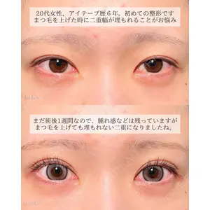 東京シンデレラ美容外科 大宮院 竹田 昌平医師の症例