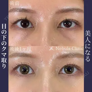ネビュラクリニック 広島院の症例