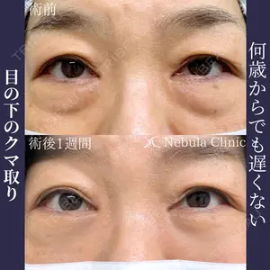 ネビュラクリニック 広島院の症例