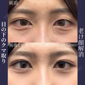 ネビュラクリニック 広島院の症例