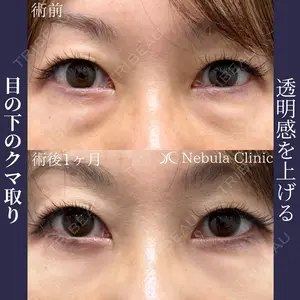 ネビュラクリニック 広島院の症例
