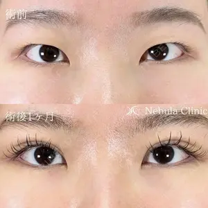 ネビュラクリニック 広島院の症例