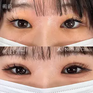 ネビュラクリニック 広島院の症例