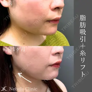 ネビュラクリニック 広島院の症例