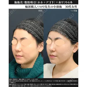 湘南美容クリニック 川崎院 伊藤 賀敏医師の症例