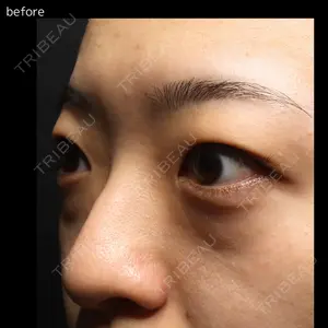 吉祥寺アイビークリニックの症例