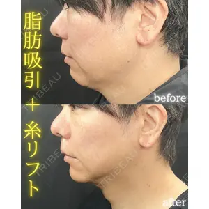 THE FIRST CLINIC 町田院 木暮 啓一郎医師の症例