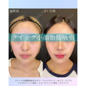 ルラ美容クリニック 札幌院 佐藤 雄紀医師の症例