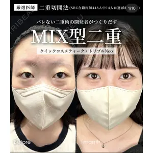 湘南美容クリニック 大阪梅田院 横谷 仁彦医師の症例