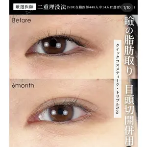 湘南美容クリニック 大阪梅田院 横谷 仁彦医師の症例