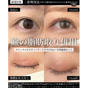 湘南美容クリニック 大阪梅田院 横谷 仁彦医師の症例