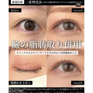 湘南美容クリニック 大阪梅田院 横谷 仁彦医師の症例