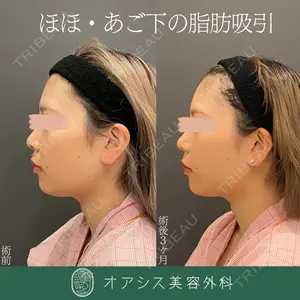 オアシス美容外科 遠藤 剛史医師の症例