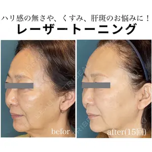 椿クリニック 名古屋院の症例