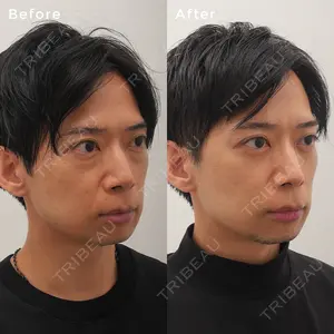 東京イセアクリニック 酒井 新介医師の症例