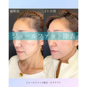 ルラ美容クリニック 札幌院 佐藤 雄紀医師の症例