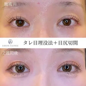 LOUIS CLINIC 二子玉川院【ルイクリニック】 小松 塁医師の症例