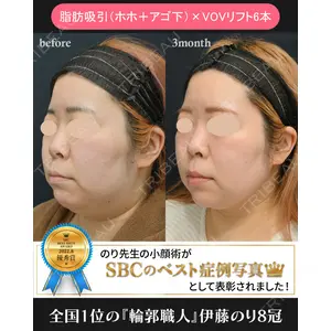 湘南美容クリニック 川崎院 伊藤 賀敏医師の症例