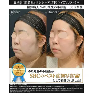 湘南美容クリニック 川崎院 伊藤 賀敏医師の症例