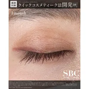 湘南美容クリニック 大阪梅田院 横谷 仁彦医師の症例