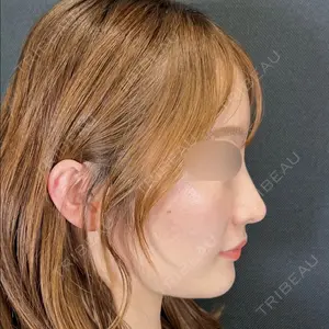 Days Beauty Clinicの症例