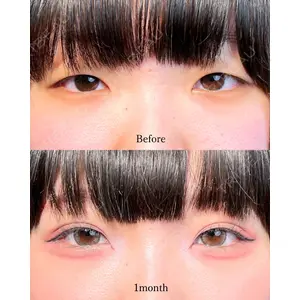 東京シンデレラ美容外科 池袋院 山本 紘子医師の症例