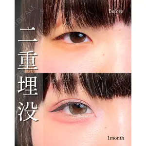 東京シンデレラ美容外科 池袋院 山本 紘子医師の症例