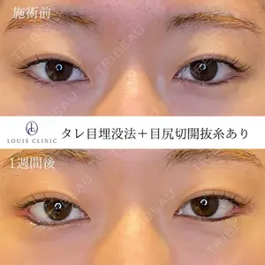 LOUIS CLINIC 二子玉川院【ルイクリニック】 小松 塁医師の症例