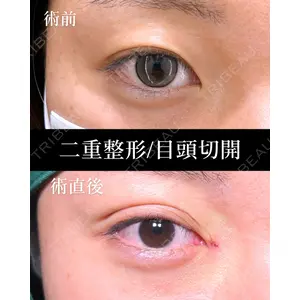 HAAB×DREAM BEAUTY CLINIC 東京本院 田中 優太医師の症例