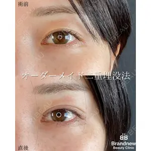 Brandnew Beauty Clinic 平山 容成医師の症例