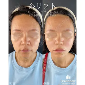 Brandnew Beauty Clinic 平山 容成医師の症例