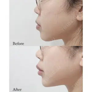 L‘amour clinic Tokyo【ラムールクリニック東京】の症例