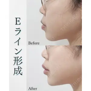 L‘amour clinic Tokyo【ラムールクリニック東京】の症例
