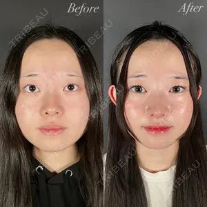 R Beauty CLINIC 大阪院 小池 泰弘医師の症例