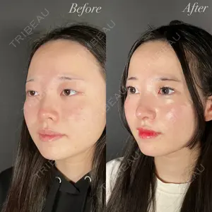 R Beauty CLINIC 大阪院 小池 泰弘医師の症例