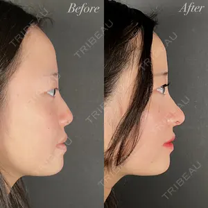 R Beauty CLINIC 大阪院 小池 泰弘医師の症例