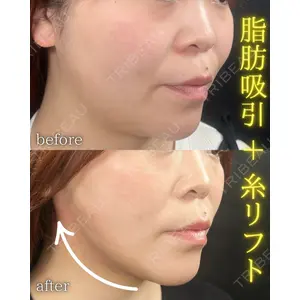 THE FIRST CLINIC 町田院 木暮 啓一郎医師の症例