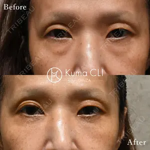 Kuma CLI 【クマクリ】 毛利 理人医師の症例