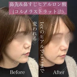 ルラ美容クリニック 渋谷本院 昼間 路子医師の症例