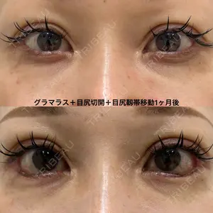 エターナル美容クリニック 久門田 詳医師の症例