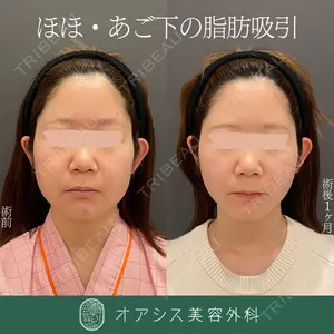 オアシス美容外科 遠藤 剛史医師の症例