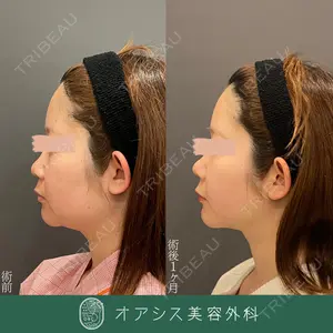 オアシス美容外科 遠藤 剛史医師の症例