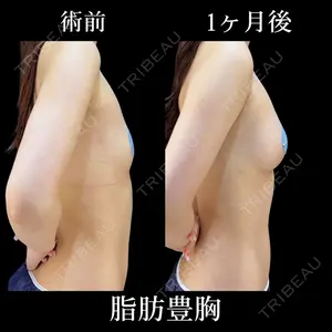 HAAB×DREAM BEAUTY CLINIC 東京本院 吉岡 修一医師の症例