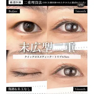 湘南美容クリニック 大阪梅田院 横谷 仁彦医師の症例