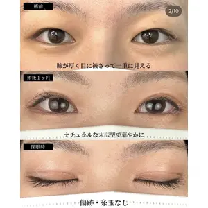 湘南美容クリニック 大阪梅田院 横谷 仁彦医師の症例