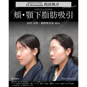 ヴェルトラクリニック 大阪院 河中聡之医師の症例