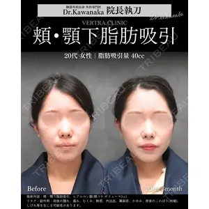 ヴェルトラクリニック 大阪院 河中聡之医師の症例