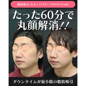 湘南美容クリニック 川崎院 伊藤 賀敏医師の症例