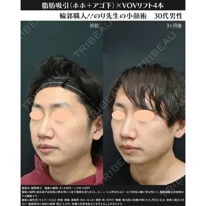 湘南美容クリニック 川崎院 伊藤 賀敏医師の症例
